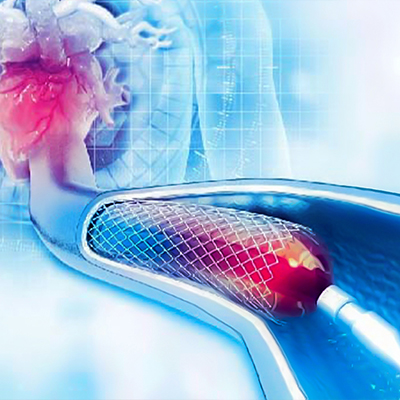 Interventional Cardiology